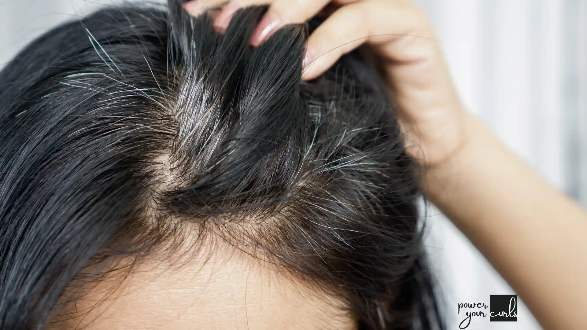 What Causes Hair Greying and Can It Be Reversed? 1 Post