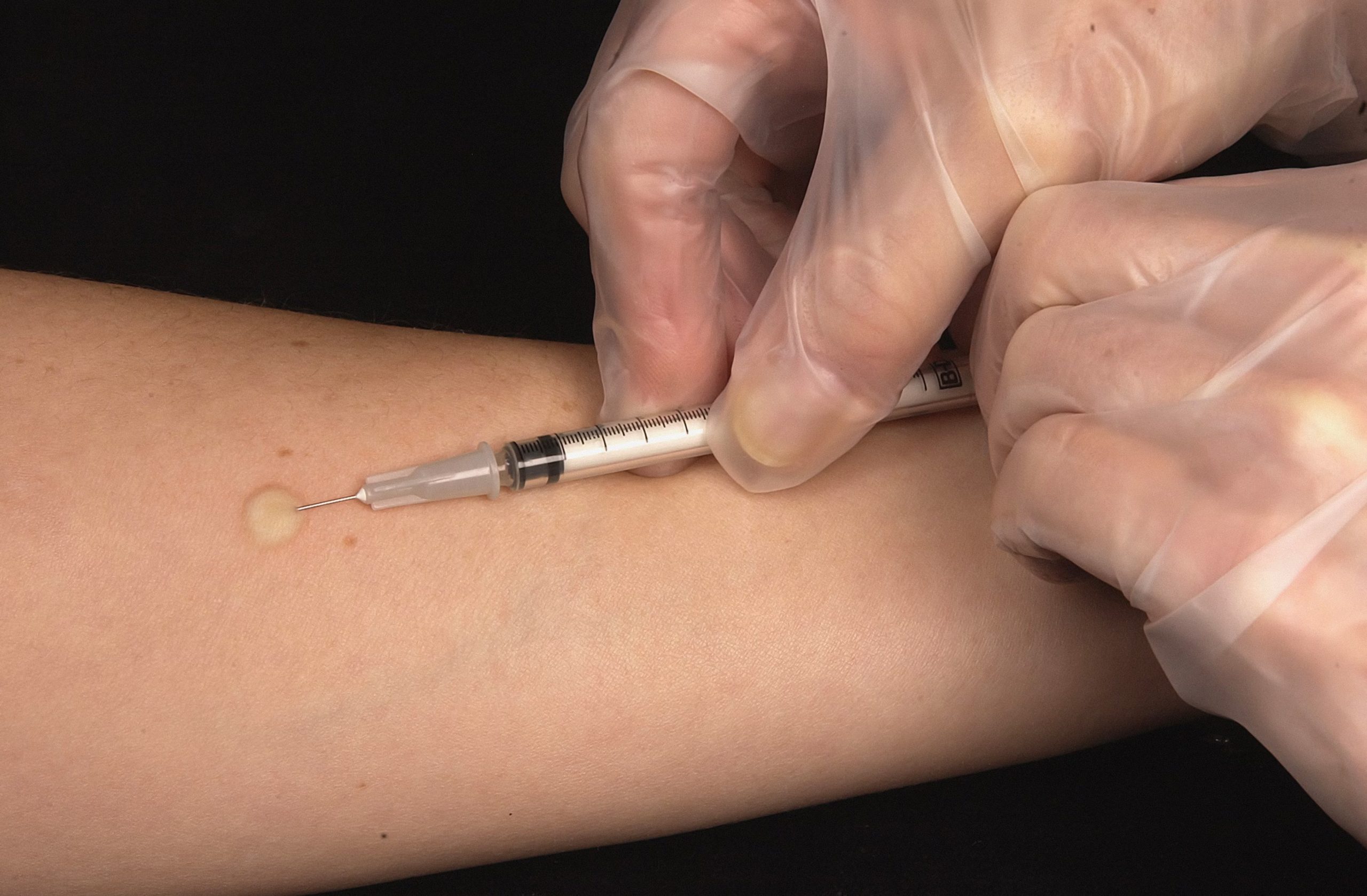 Hair & Skin Tests: Do It The Right Way! 1 Post