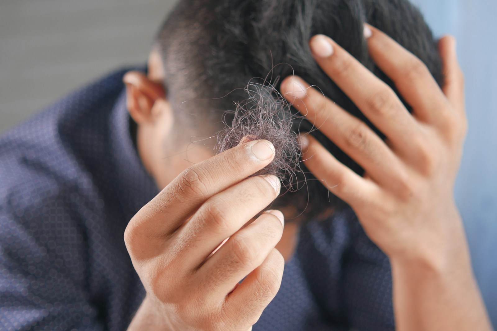 Telogen Effluvium: What You Need To Know 1 a man is combing his hair with his hands