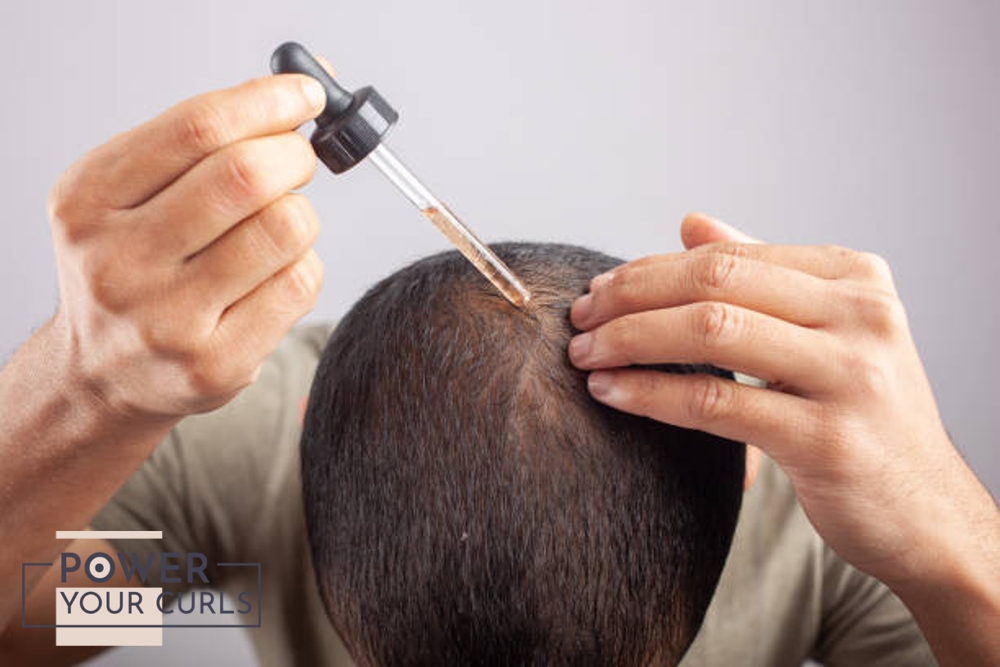 A man applying minoxidil to the top of his head.