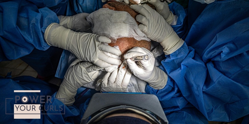 Six Effective Treatments For Hair Loss 4 Surgeons in an operating room performing a hair transplant procedure under sterile conditions.